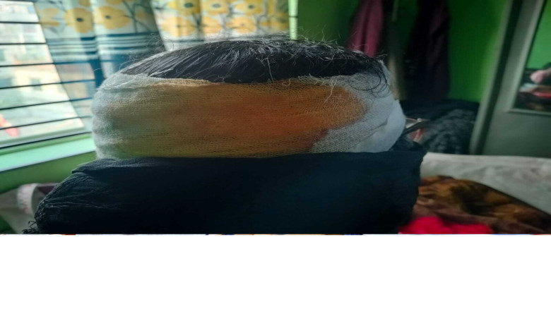 রাজনৈতিক গণসংযোগে নারী কর্মীর ওপর কোপ