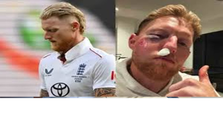 নেটে অনুশীলন দেখতে গিয়ে বলের আঘাতে স্টোকস