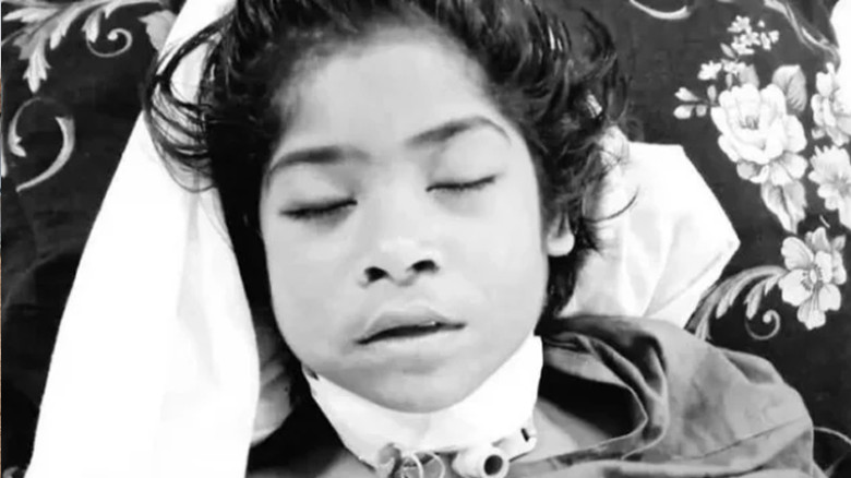 চট্টগ্রামে গলাকাটা অবস্থায় উদ্ধার শিশু ইরার মৃত্যু