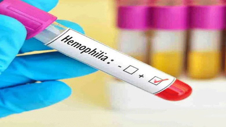 হিমোফিলিয়া: রক্ত জমাট না বাঁধার জটিল রোগ ও এর লক্ষণ
